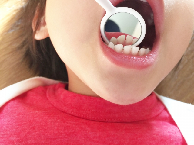 child dental treatment10 1.jpg