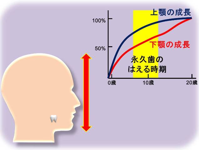 歯の欠損と顔の大きさ.jpg