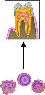 免疫細胞と歯周病.jpg